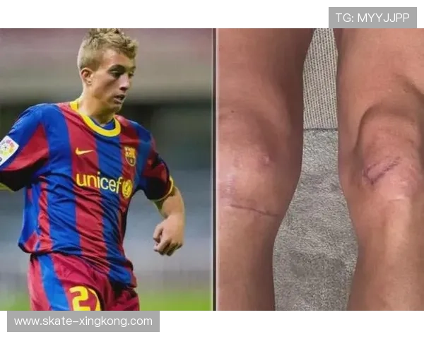 粗腿球星踢足球的力量与技巧并存，谁是赛场上最具震撼力的球员？